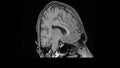 MRI Brain 3D Rotation