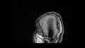 MRI Brain Sagittal Navigation