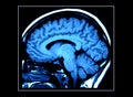 MRI Brain Scan Royalty Free Stock Photo