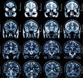 MRI Brain Scan Royalty Free Stock Photo