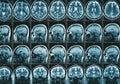 MRI brain scan or magnetic resonance of head image results Royalty Free Stock Photo