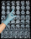 MRI brain scan or magnetic resonance image results, neurology point Royalty Free Stock Photo