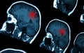 MRI brain scan Royalty Free Stock Photo