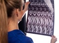 MRI diagnostics of cervical spine Royalty Free Stock Photo