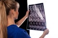 MRI diagnostics of cervical spine Royalty Free Stock Photo