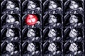 MRI heart or Cardiac MRI Royalty Free Stock Photo