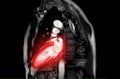 MRI heart or Cardiac MRI Royalty Free Stock Photo