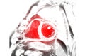 MRI heart or Cardiac MRI ( magnetic resonance imaging ) of heart Short axis view for diagnosis heart disease Royalty Free Stock Photo