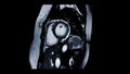 MRI heart or Cardiac MRI ( magnetic resonance imaging ) of heart. Royalty Free Stock Photo
