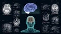 MRI of the human brain in the different projections