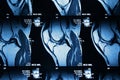 MRI image of knee Royalty Free Stock Photo