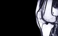 MRI Knee joint or Magnetic resonance imaging sagital view .