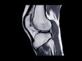 MRI Knee joint or Magnetic resonance imaging sagittal view. Royalty Free Stock Photo