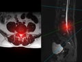 MRI L-S spine or lumbar spine Axial T2W view with sagittal plane for diagnosis spinal cord compression