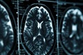 MRI or magnetic resonance image of head and brain scan. Close up view Royalty Free Stock Photo