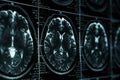 MRI or magnetic resonance image of head and brain scan. Close up view Royalty Free Stock Photo