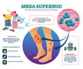 MRSA super bug vector illustration. Labeled staph infection explain scheme. Royalty Free Stock Photo