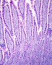 Intestinal epithelium. Goblet cells