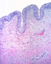 Urinary bladder mucosa