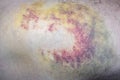 Multi-colored bruise on body. Close-up is wounded leg with bruise and abrasion. Injured skin. Household injuries, harm to health Royalty Free Stock Photo