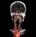 Multi view 2D and 3D Rendering image of CT angiography