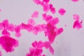 Multiple squamous epithelium under the microscope - Abstract pin