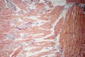 Muscle tissue