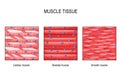 Muscle tissue: Skeletal, smooth and cardiac Royalty Free Stock Photo