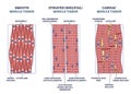 Muscle tissue with smooth, striated and cardiac examples outline diagram