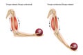 An example of an anatomical and physical movement process where the biceps are contracted and the triceps are relaxed, the biceps