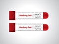 Blood sample tube positive for Marburg virus, Blood in the test tube