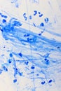 Mycobacterium tuberculosis positive in sputum smear Royalty Free Stock Photo