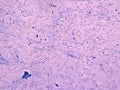 Histology of myelin and nissel substance in the brain LFB/CV