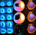 Myocardial defect nuclear medicine Royalty Free Stock Photo