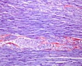 Myocardium. Intercalated disks