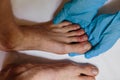 Mysterious skin condition that causes purple, blue or red discoloration in toes and occasionally fingers. New symptom of
