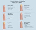 nail desease infographic. Medicine poster