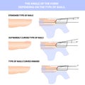 Nail extension in shape. How to apply the shape of the nail