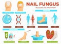 Nail fungus reasons and treatment poster with text vector