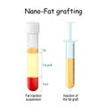 Nano-Fat grafting. test tube with Fat injection suspension. syringe with Injection of the fat graft