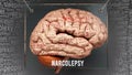 Narcolepsy in human brain