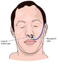 Nasal bridle