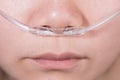 Nasal cannula for oxygen delivery on a woman patient