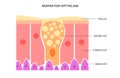 Nasal epithelium concept