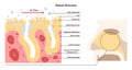 Nasal mucosa anatomy. Nasal mucous membrane lining the respiratory tract Royalty Free Stock Photo