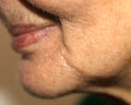 Nasolabial wrinkles. Wrinkles on the skin of the face of the neck. Flabby cheeks and neck