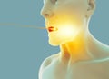 A nasopharyngeal swab is a method for collecting a clinical test sample of nasal secretions from the back of the nose and throat.