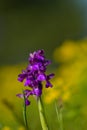 Natural hybridization between the Lady orchid Orchis purpurea and the Military orchid Orchis militaris Royalty Free Stock Photo