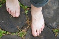 Natural physical therapy for flat feet. Female feet on the log r