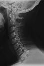 Neck and nape x-ray scan Royalty Free Stock Photo